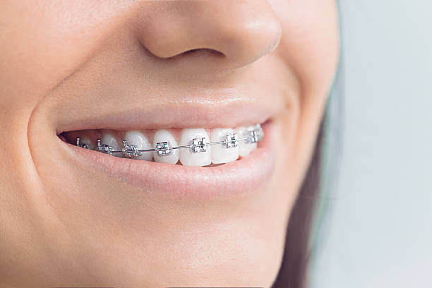Best Wisdom Tooth Removal  in Rock Hall, MD